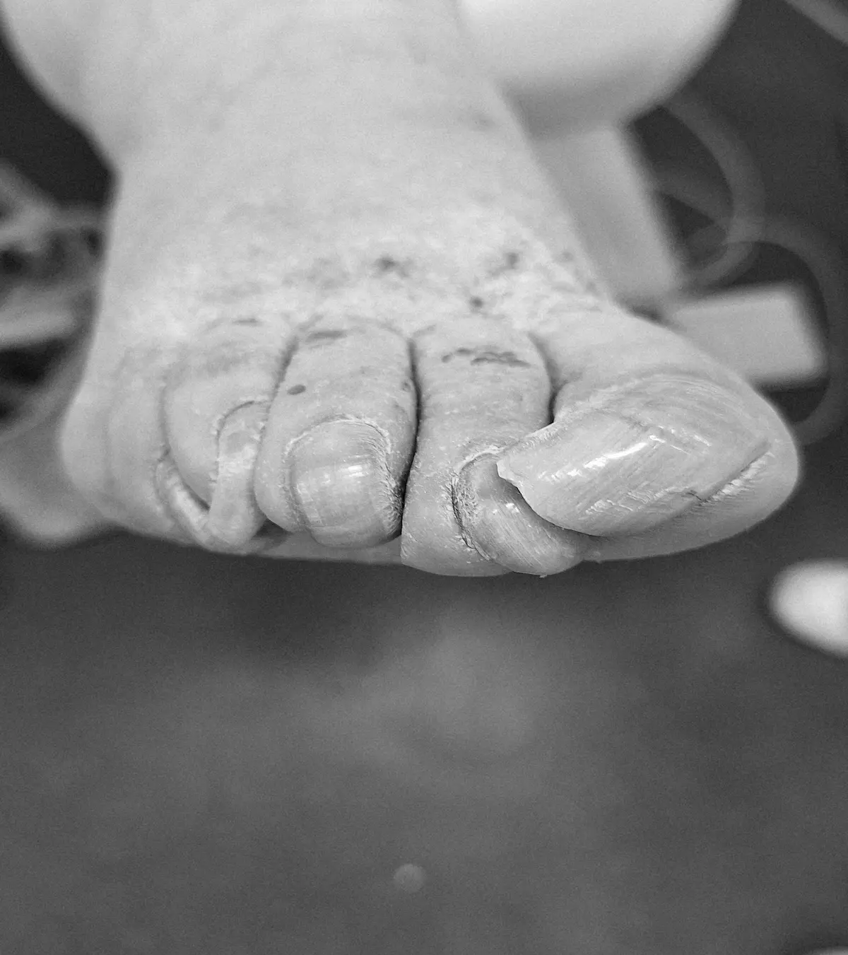 Voor — Fotogalerij